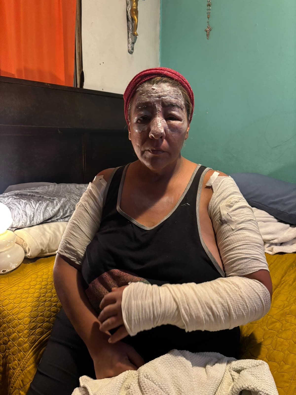 Rifa con causa busca ayudar a Karime tras incendio; hay hasta este martes para participar