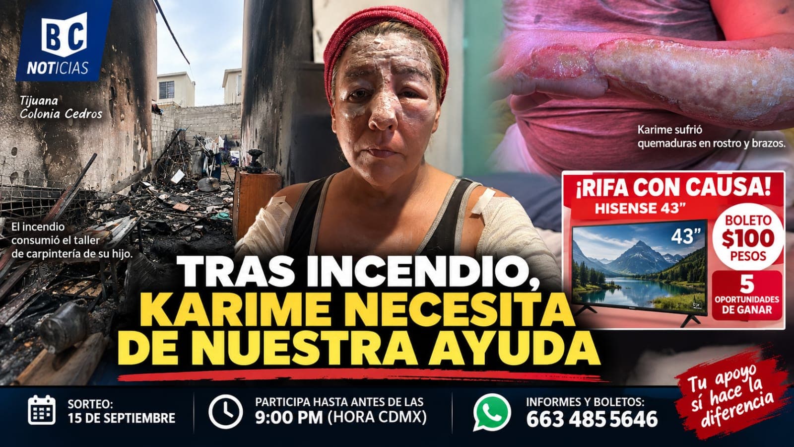 Rifa con causa busca ayudar a Karime tras incendio; hay hasta este martes para participar